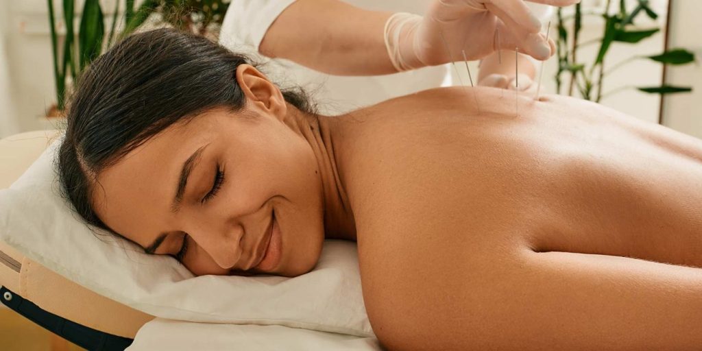 Woman on bed receiving acupuncture treatment for back issue.